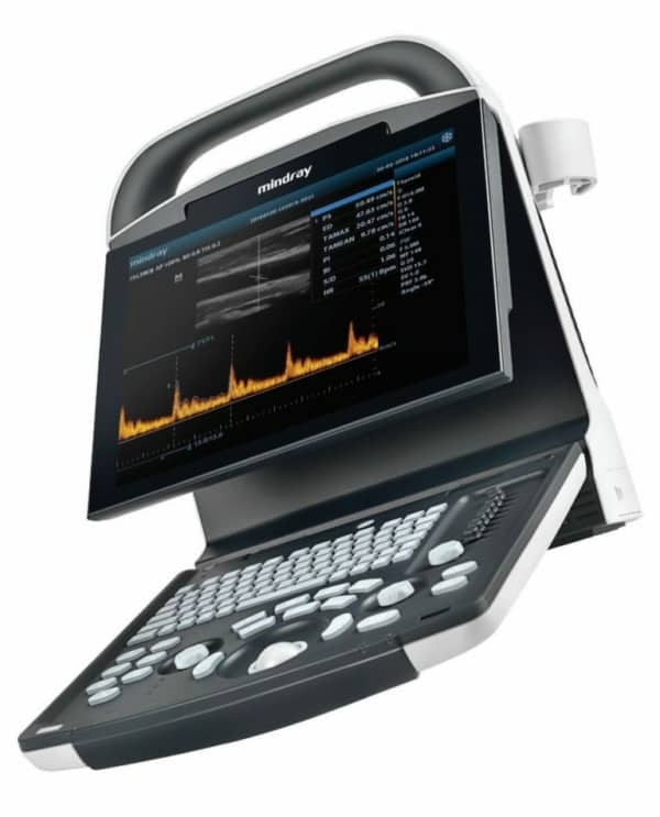 mindray dp-10 ultrasound machine