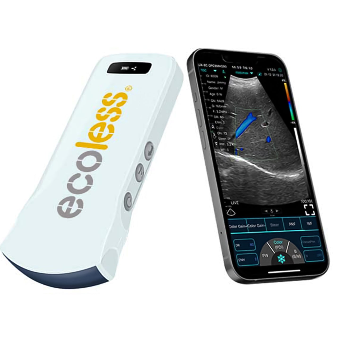 Ultrasound Proble (Ecoles) 3in1