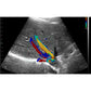 Ultrasound Proble (Ecoles) 3in1