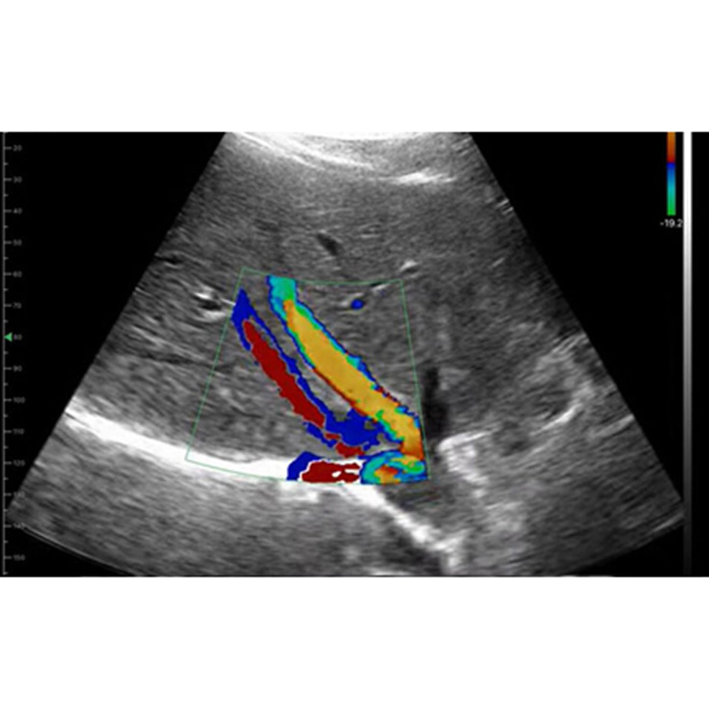 Ultrasound Proble (Ecoles) 3in1