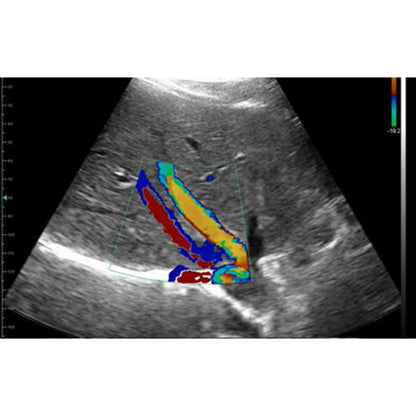 Ultrasound Proble (Ecoles) 3in1