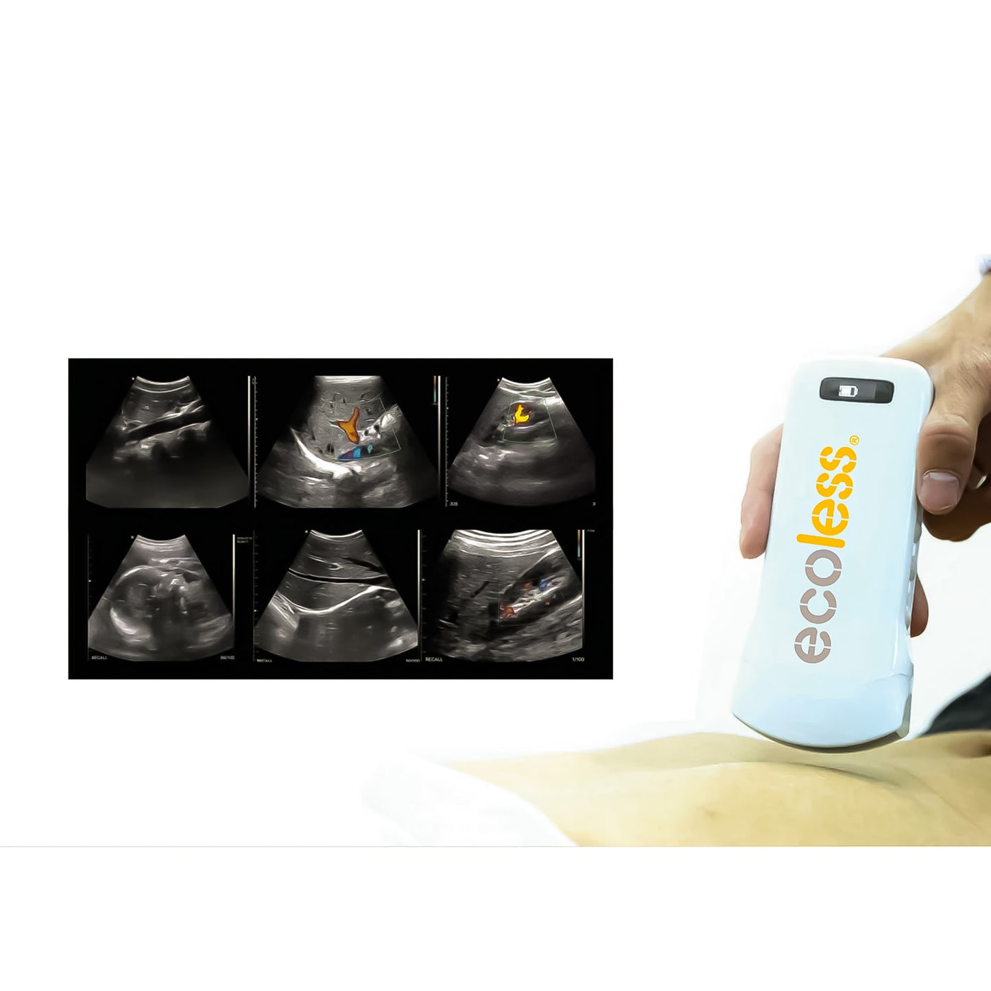 Ultrasound Proble (Ecoles) 3in1