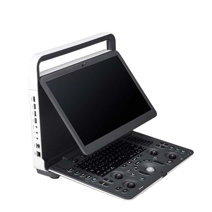 Sonoscape ultrasound E1