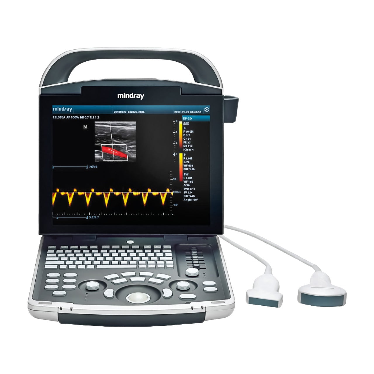 mindray dp-10 ultrasound machine – Abronn Medical Units UK Ltd.